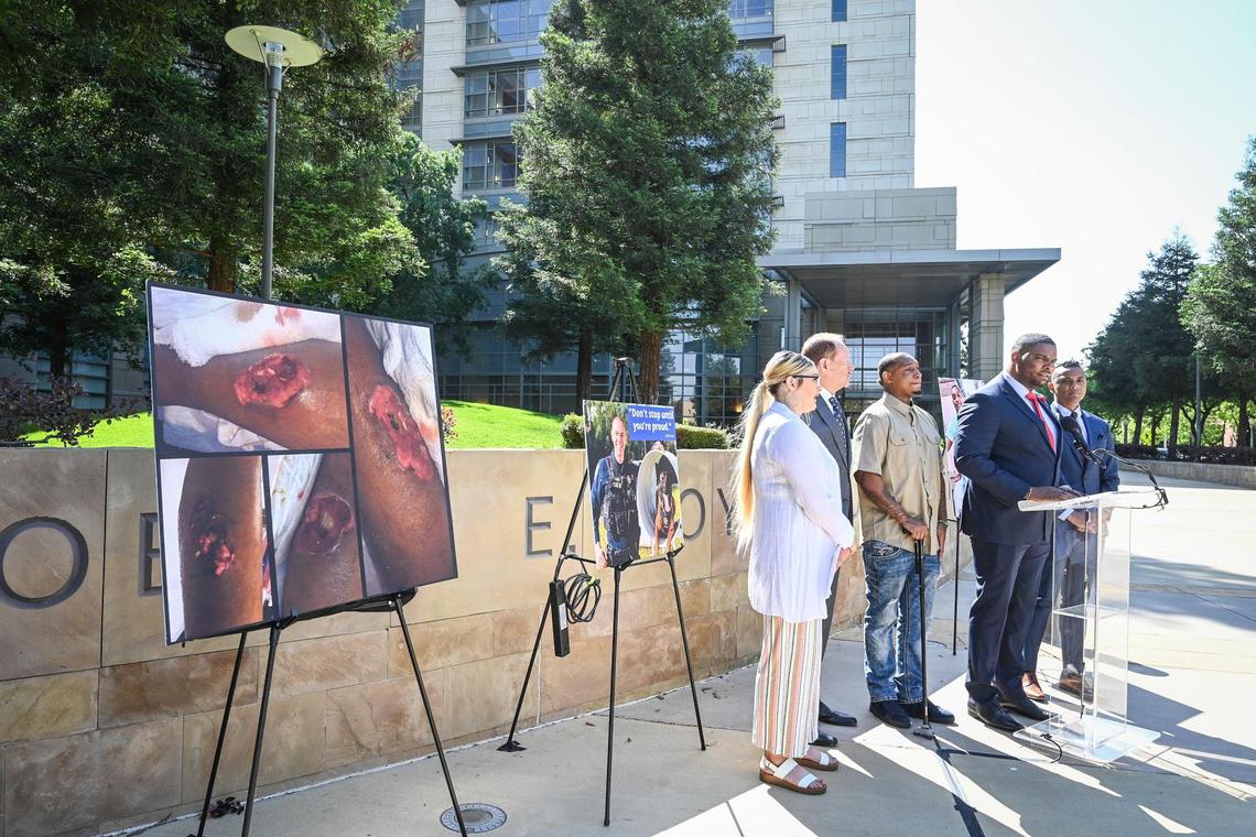 Lawyers for Jamal Jones, center, stand near photos of Jones’ injuries from a police canine during a 2021 traffic stop while holding a news conference to announce a lawsuit with be filed against the Clovis Police Department, accusing the department of racial profiling, excessive force and severe injury from a police canine, outside the Robert E Coyle Federal Building in downtown Fresno on Thursday, April 28, 2022.