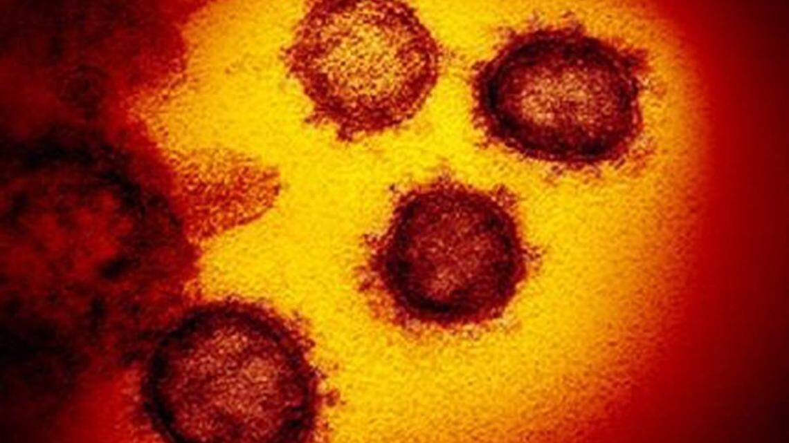 This transmission electron microscope image shows SARS-CoV-2, also known as 2019-nCoV, the coronavirus virus that causes COVID-19.