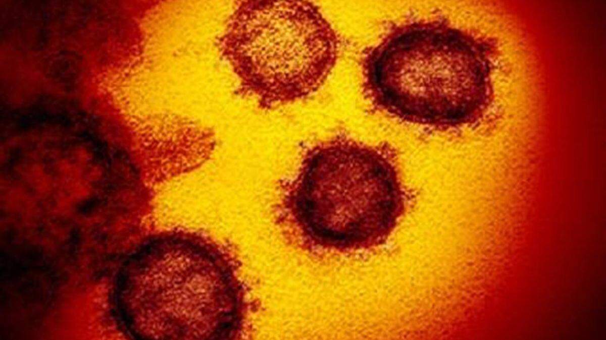 This transmission electron microscope image shows SARS-CoV-2, also known as 2019-nCoV, the coronavirus virus that causes COVID-19.