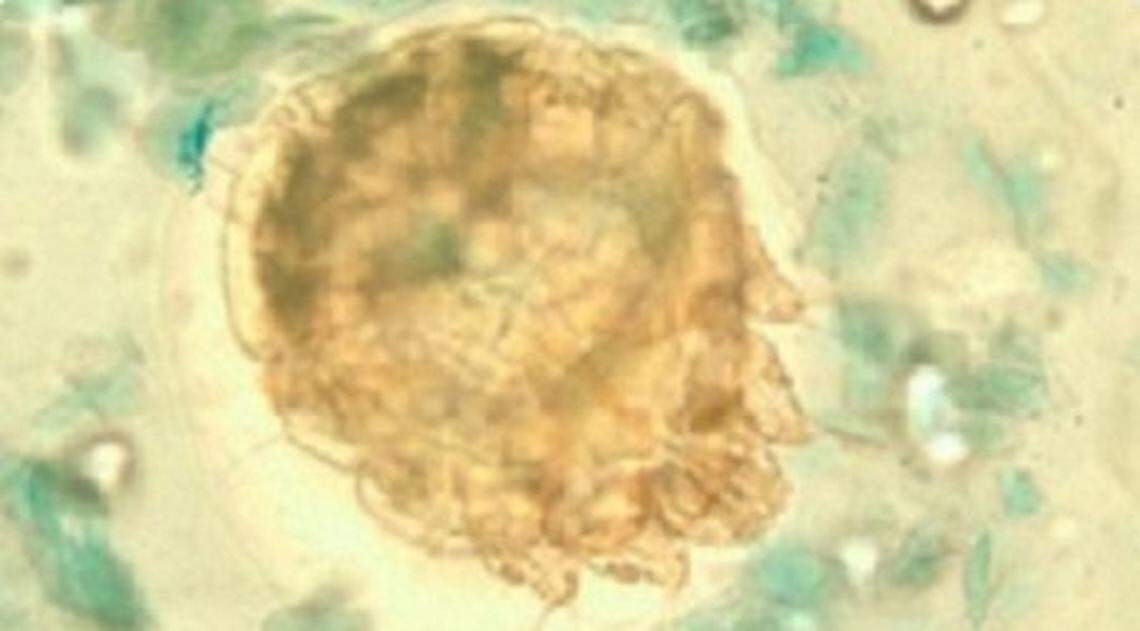 Funcionarios de Golden State Annex, una instalación de detención de ICE en Kern County, confirmaron los reportes de un brote de sarna.