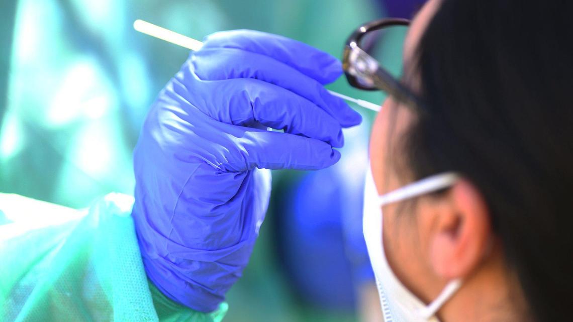 United Health Centers conducts free COVID-19 testing at Lions Park Saturday morning, August 1, 2020 in Fresno.