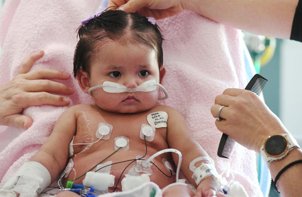 Eight-month-old Victoria Saypen gets her hair combed at Valley Children’s Hospital, Thursday, March 2, 2023 in Madera County.