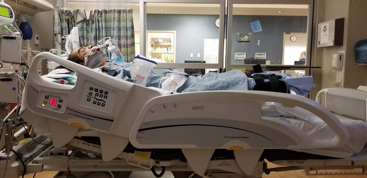 Geronimo Gonzalez lays in a bed at Community Regional Medical Center after both his legs were cut off following a DUI crash. Gonzalez was standing outside his home when a car hit him.