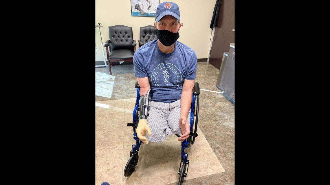 Fresno man loses three limbs, accused doctors of malpractice | Fresno Bee