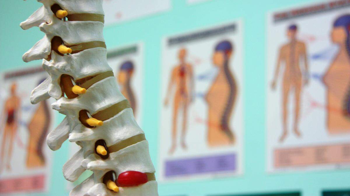 A plastic model shows how problems with the discs between spinal vertebrae can push against nerves. Fresno resident Tammy Johnson is seeking Social Security disability benefits because near-constant pain from bulging discs in her neck and back keep her from working since a fall in 2015. She has waited for 20 months for hearing to appeal a denial of her disability claim.