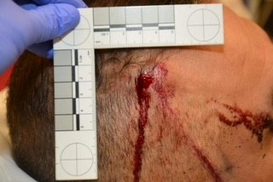 Fresno police on Wednesday, March 30, 2022, released photos of the injuries a detective suffered during an attack in his office the previous day, according to police.
