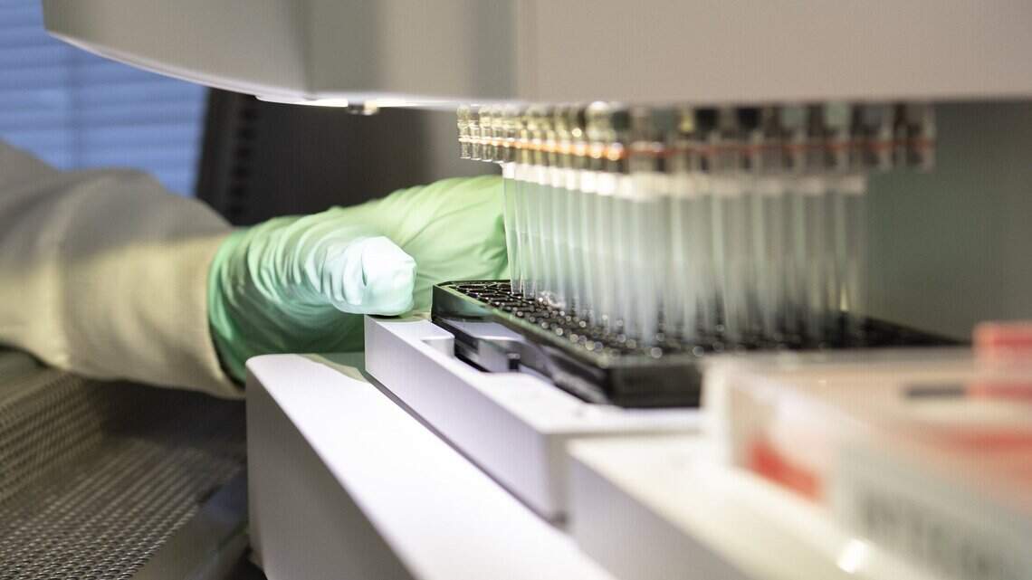 It’s final: Medicare doesn’t want to pay for people with Alzheimer’s disease