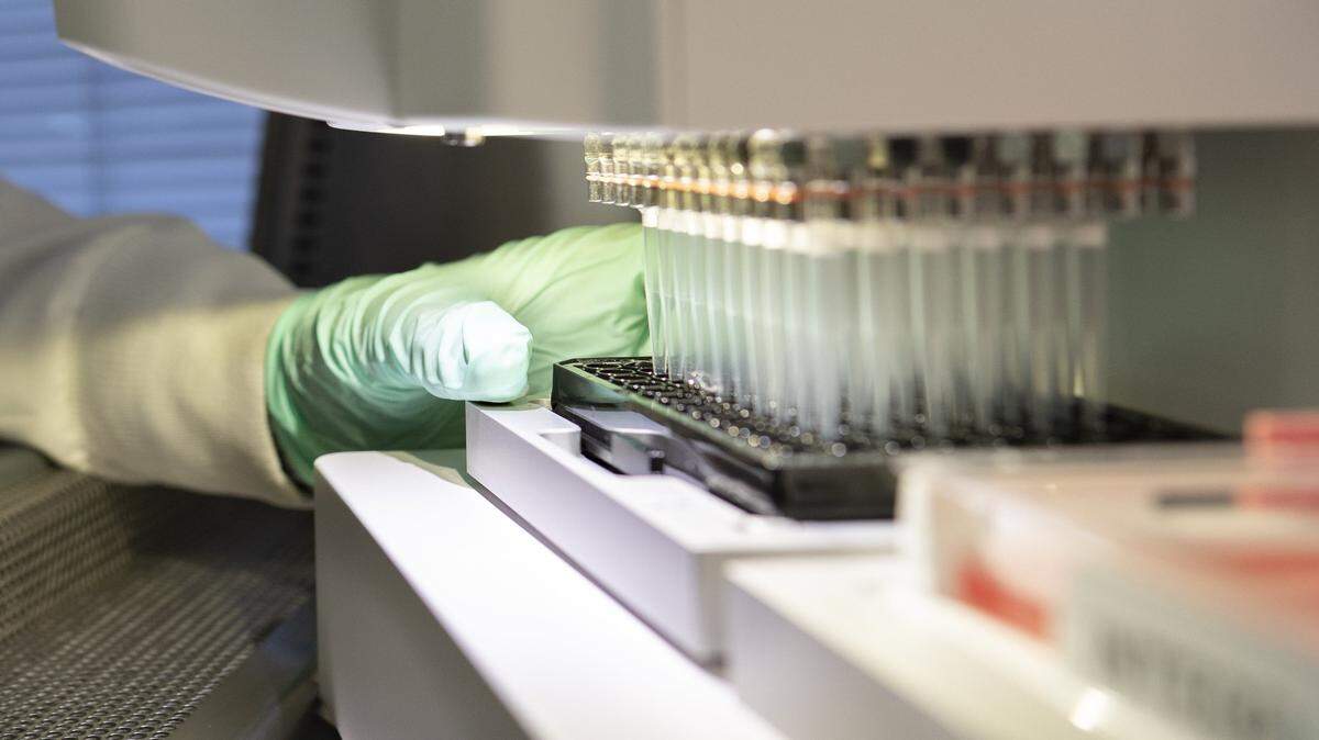 In this 2019 photo provided by Biogen, a researcher works on the development of the medication aducanumab in Cambridge, Mass. On Monday, June 7, 2021, the Food and Drug Administration approved aducanumab, the first new drug for Alzheimer’s disease in nearly 20 years, disregarding warnings from independent advisers that the much-debated treatment hasn’t been shown to help slow the brain-destroying disease. The drug is now marketed as Aduhelm.