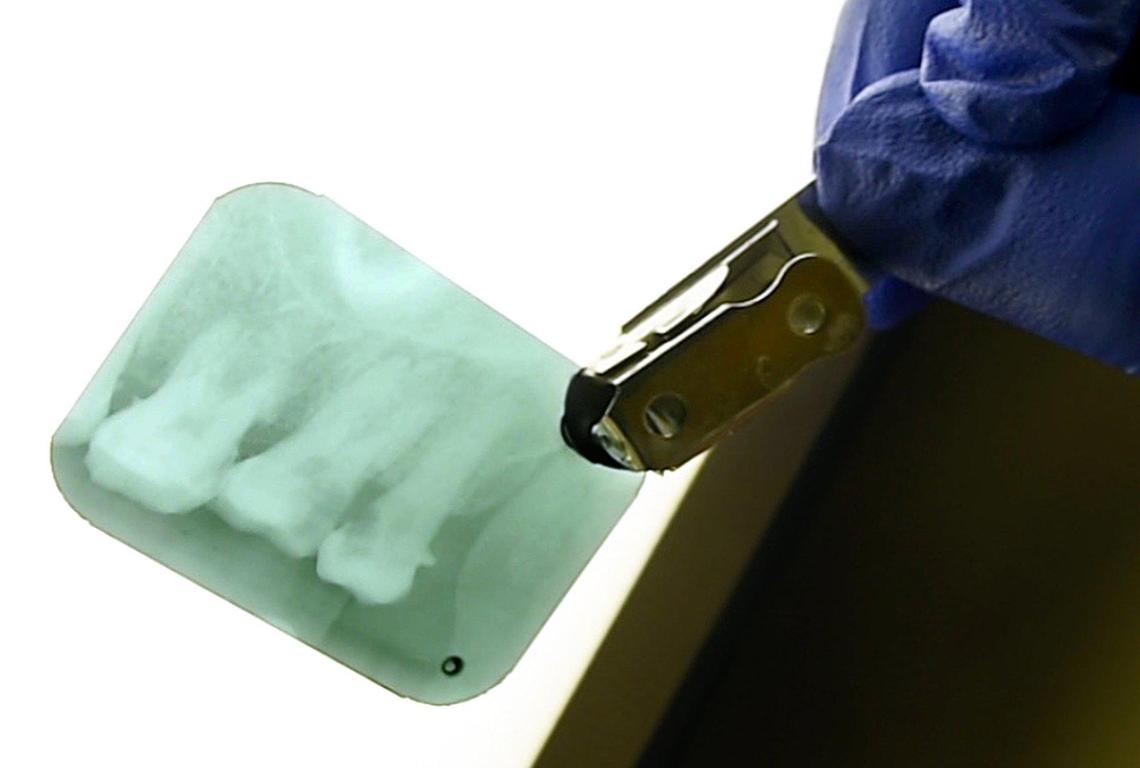 Dental assistant Bertha Gonzalez looks at a patient’s xray at Holy Cross Clinic at the Poverello House.