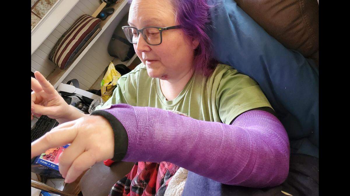 Jennifer Ward suffered a broken wrist when she was “bull rushed” by a shoplifter Sunday at her northeast Fresno business.