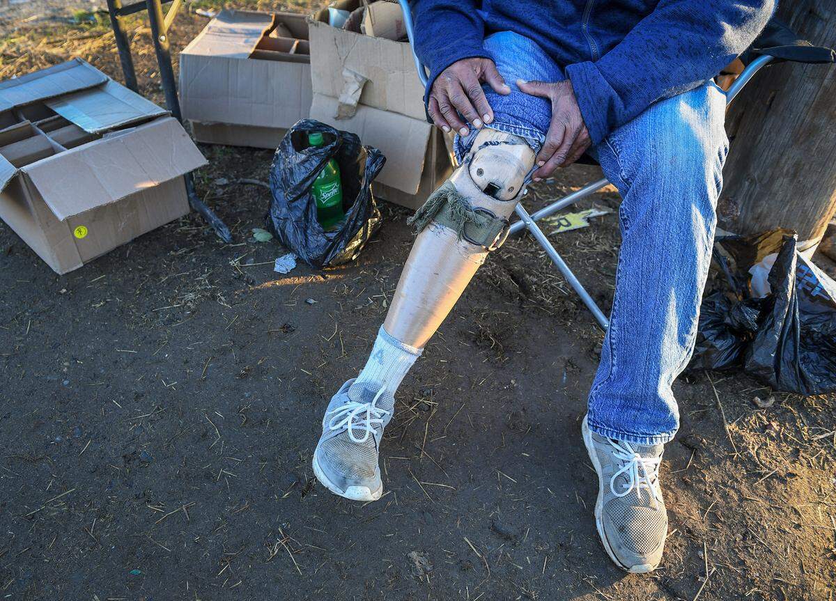 Guillermo Lozano shows his worn prosthetic leg on the side of the road in rural Madera County, where he sells flowers and gifts on Friday, Dec. 18, 2020. A GoFundMe account has been started to help Lozano purchase a new prosthetic leg.