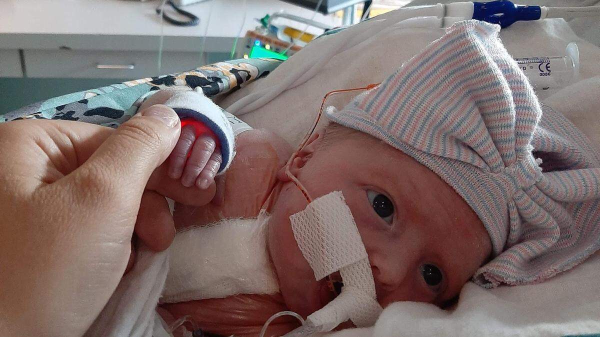 On March 15, Ryan Jagd and MaKala Rankin welcomed twin girls Maddison, above, and McKenna into their family of three, including 2-year-old daughter Harper. While pregnant it was discovered Maddi would be born with a defect called HLHS (hypoplastic left heart syndrome). She is not able to process enough oxygenated blood throughout her body.