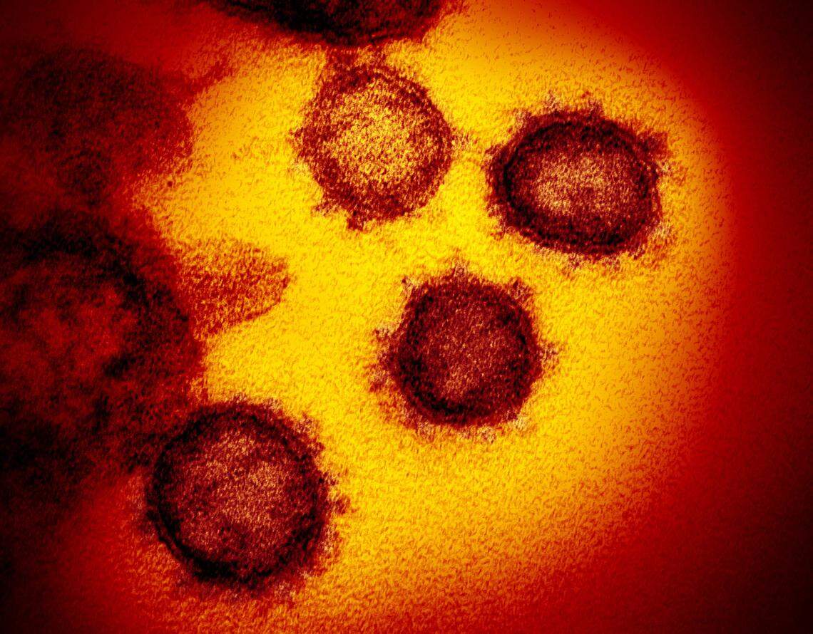 An image from an electron microscope shows SARS-CoV-2, the virus that causes COVID-19. Last week, the World Health Organization named a new variant of the virus, called omicron.