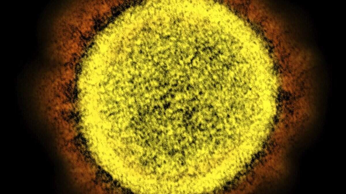 FILE - This 2020 electron microscope image made available by the National Institute of Allergy and Infectious Diseases shows a Novel Coronavirus SARS-CoV-2 particle isolated from a patient, in a laboratory in Fort Detrick, Md. Coronaviruses, including the newest one, are named for the spikes that cover their outer surface like a crown, or corona in Latin. Using those club-shaped spikes, the virus latches on to the outer wall of a human cell, invades it and replicates, creating viruses to hijack more cells. (NIAID/NIH via AP)