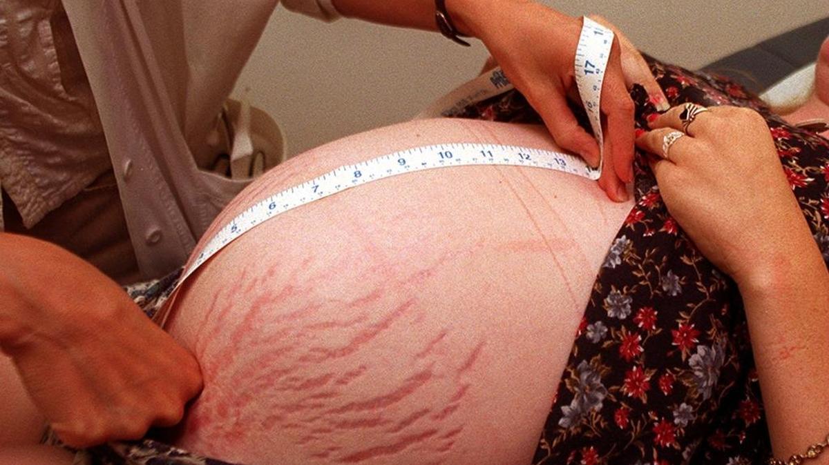 Tens of thousands of low-income pregnant women and children in the central San Joaquin Valley rely on the Children’s Healthcare Insurance Program that could run out of federal funding at the end of this year.