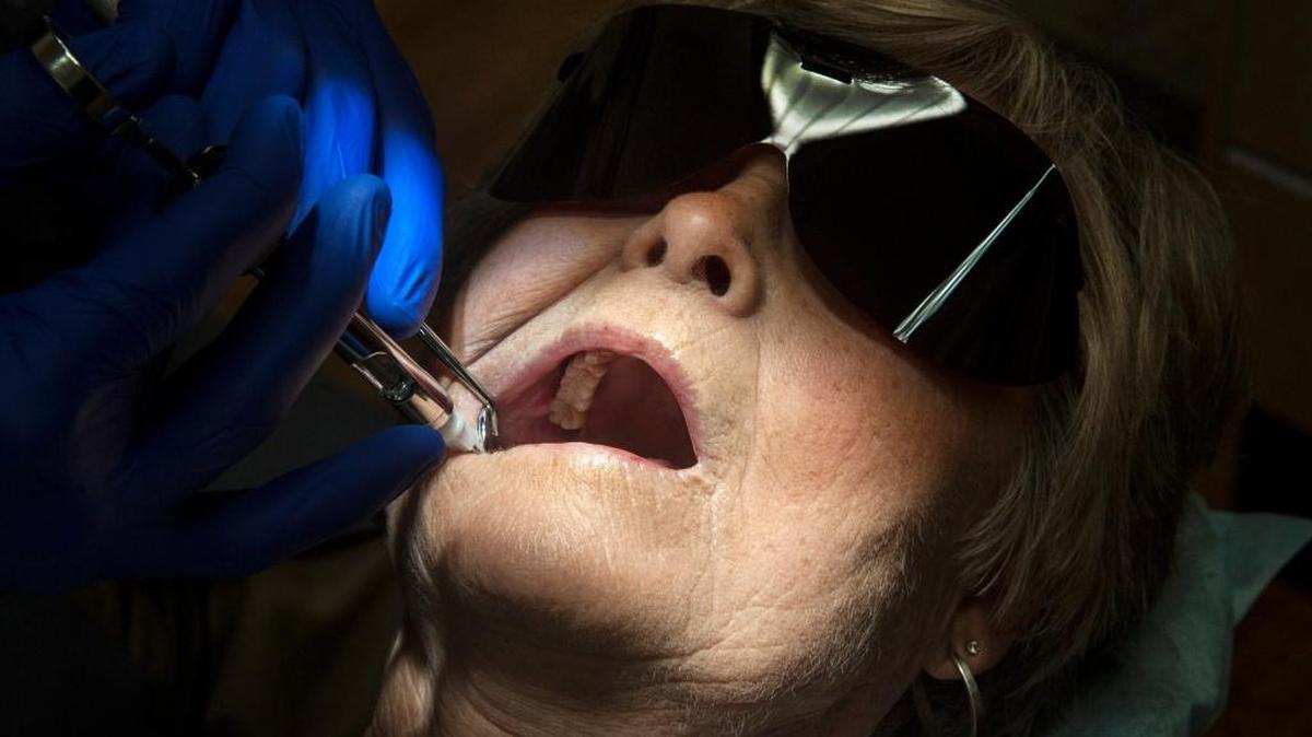 More than 7 million California adults enrolled in Medi-Cal will regain coverage for critical dental care, including crowns and partial dentures, starting in January.