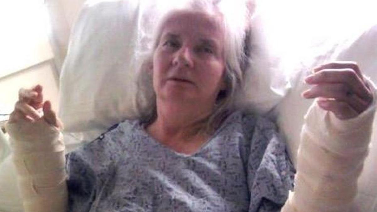 Victoria Young sustained two broken arms after she was knocked down by a large dog.