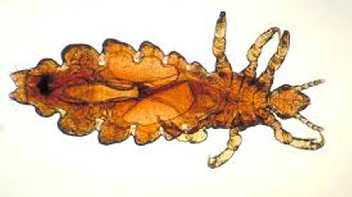 Head louse
