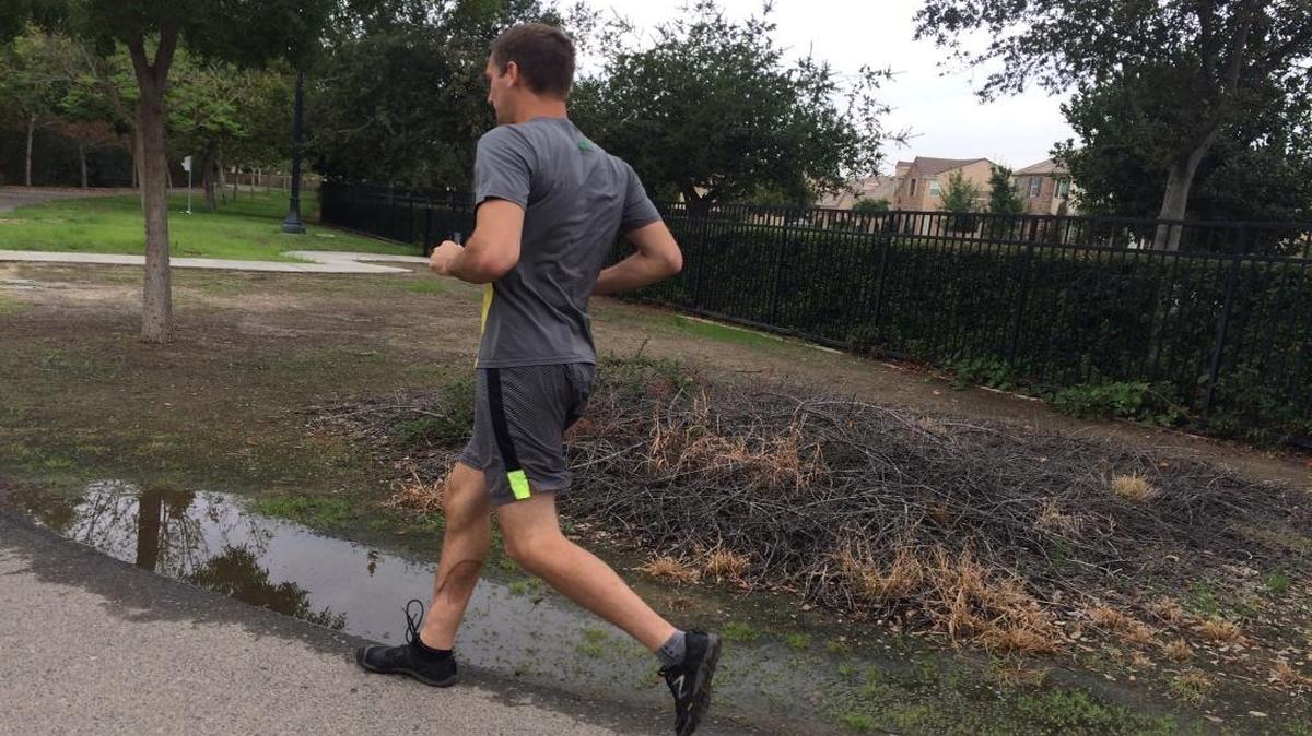 
Six months after learning how to walk again following a compound leg fracture, Gregg Hein runs one mile two to three times a week. A scar from the injury can be seen on his right calf.
