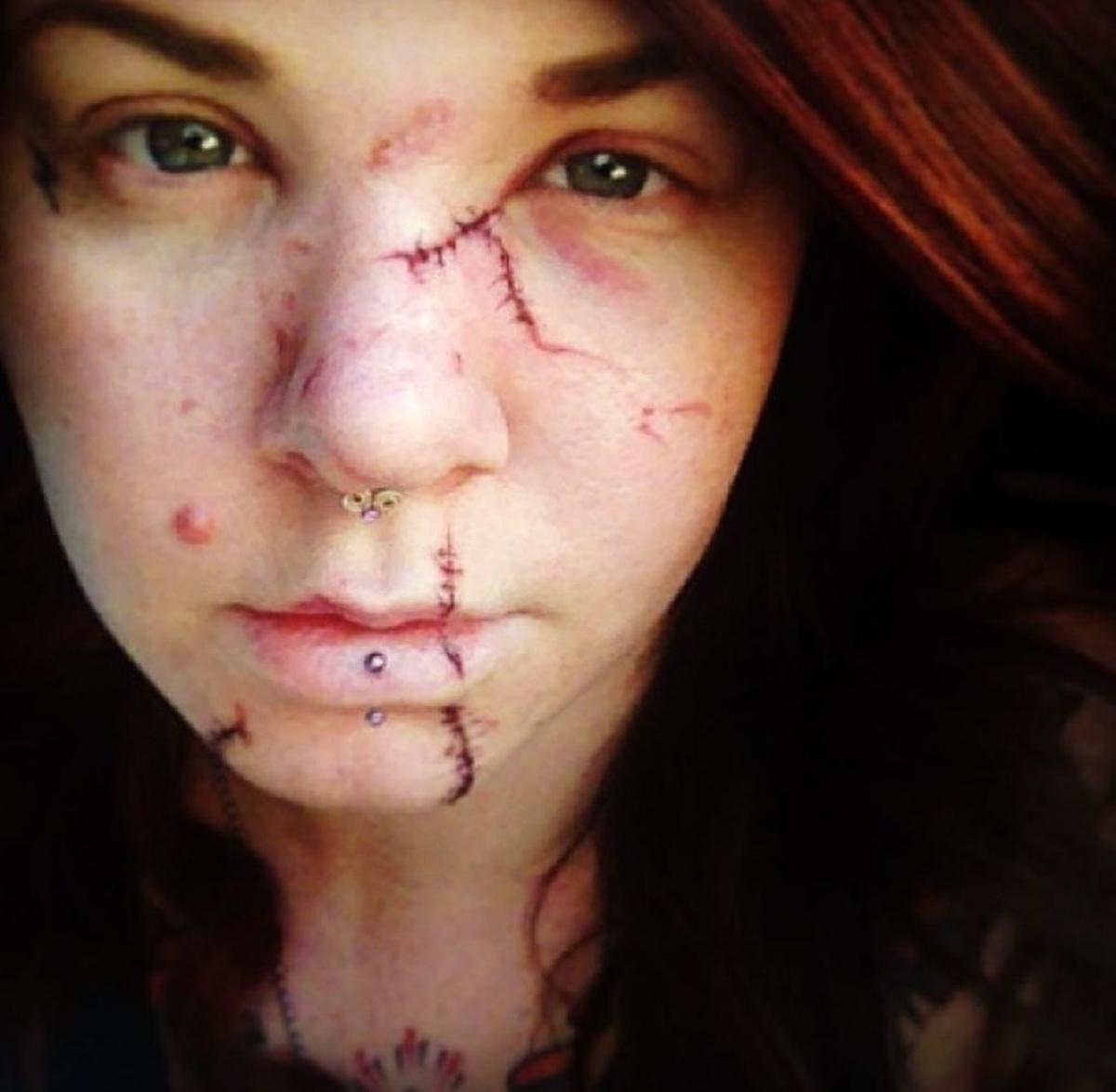 Sarah Fisher received 29 stitches on her face and nine on her chest to close gashes caused by being hit with a cocktail glass in July 2013. Kelley Duley, 45, has been convicted of breaking the glass on Fisher and is awaiting sentencing in Fresno County Superior Court.