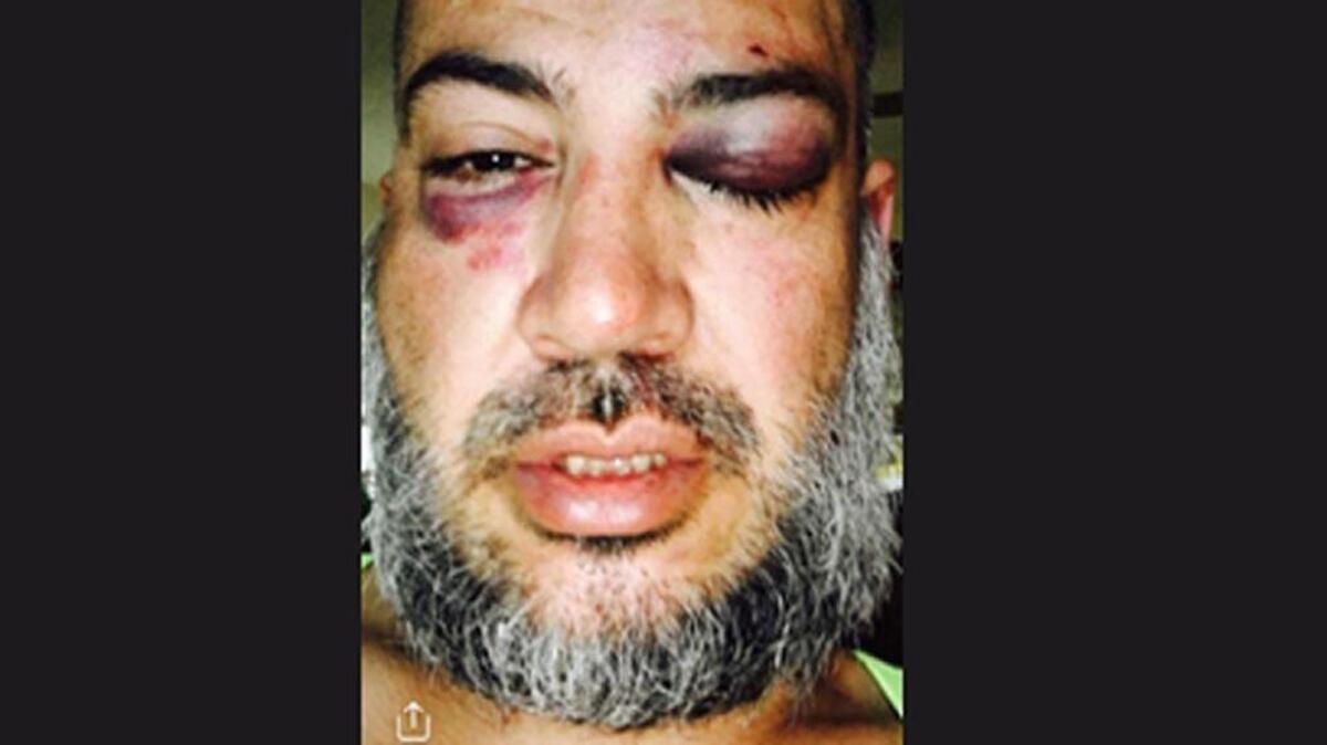 Ramiro Huerta, 41, of Strathmore, has filed a federal civil rights lawsuits that accuses Tulare County sheriff’s deputies of beating him and calling him anti-homosexual slurs in April 2017.