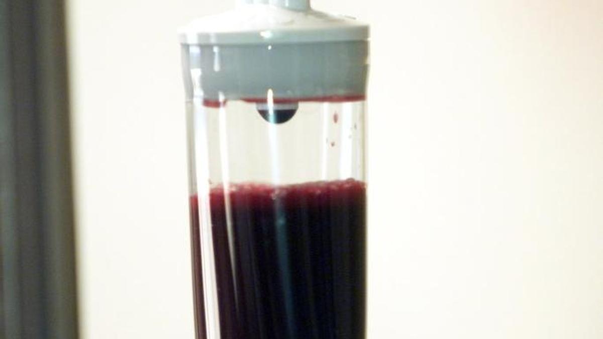 Blood transfusions take an hour to an hour and a half before every drop of blood from a donated pint finds its way to the patient’s circulatory system.