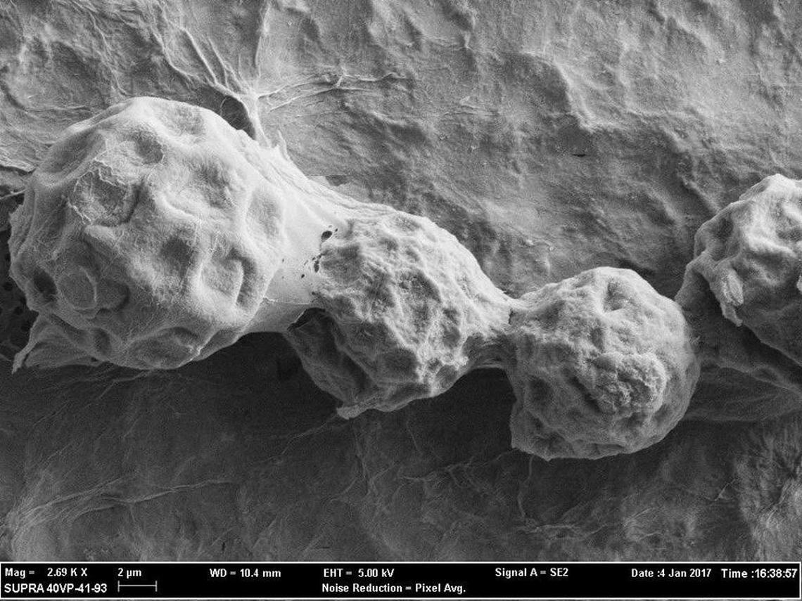 Valley fever spores magnified under a microscope.