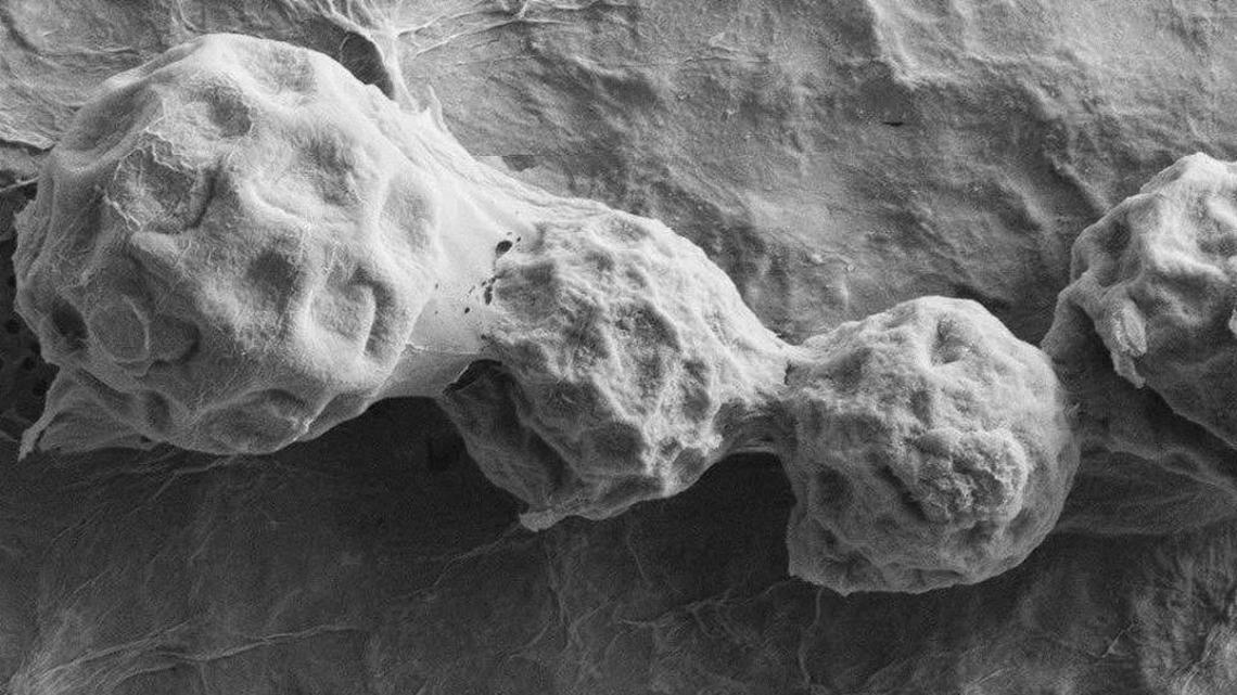 Valley fever spores magnified under a microscope.