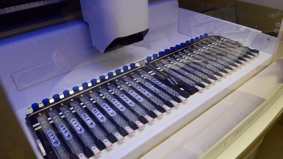 
A BD Max analysis machine tests samples in the Community Medical Center lab Wednesday, March 12, 2014. Dr. Dominic Dizon and lab supervisor Marilyn Mitchell have found a way to use the same machine to test for Valley fever much faster than previously done.
