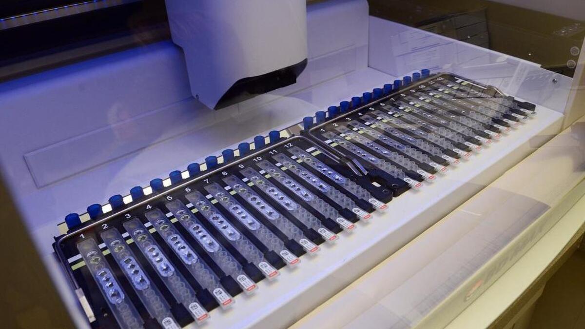 
A BD Max analysis machine tests samples in the Community Medical Center lab Wednesday, March 12, 2014. Dr. Dominic Dizon and lab supervisor Marilyn Mitchell have found a way to use the same machine to test for Valley fever much faster than previously done.
