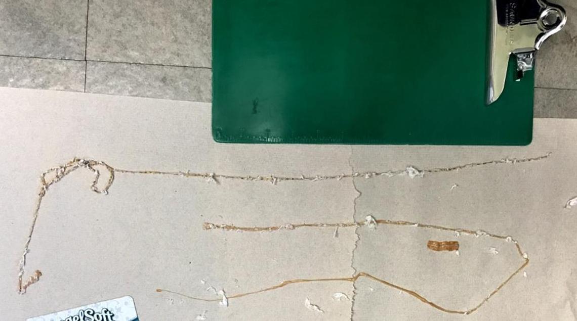 A 5 1/2-foot tapeworm was unraveled on paper towels on the floor of the emergency department at Community Regional Medical Center. The patient brought the tapeworm to the hospital when he came for treatment recently.