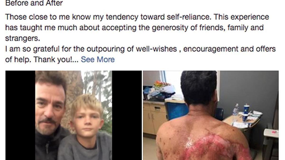A lightning strike hit Chris Lovera and his children as they were backpacking near Sequoia National Park.