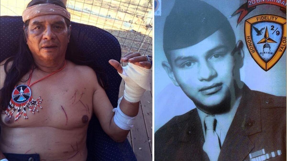 
At left: Larry Yepez shows the wounds he suffered when a black bear attacked him outside his home in Midpines in the predawn hours on Thursday, Aug. 13. At right: Yepez in the 1960s, when he served in the Marines and fought in Vietnam.
