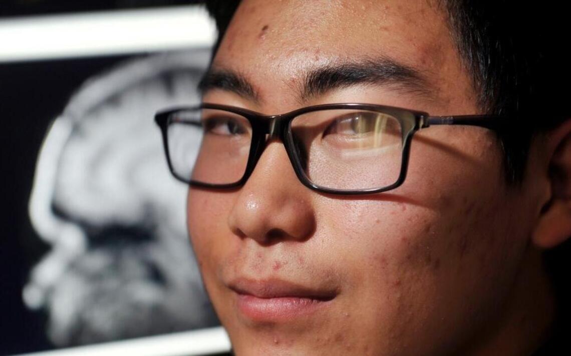 Valley Children’s Hospital dealing with sharp increase in concussion patients