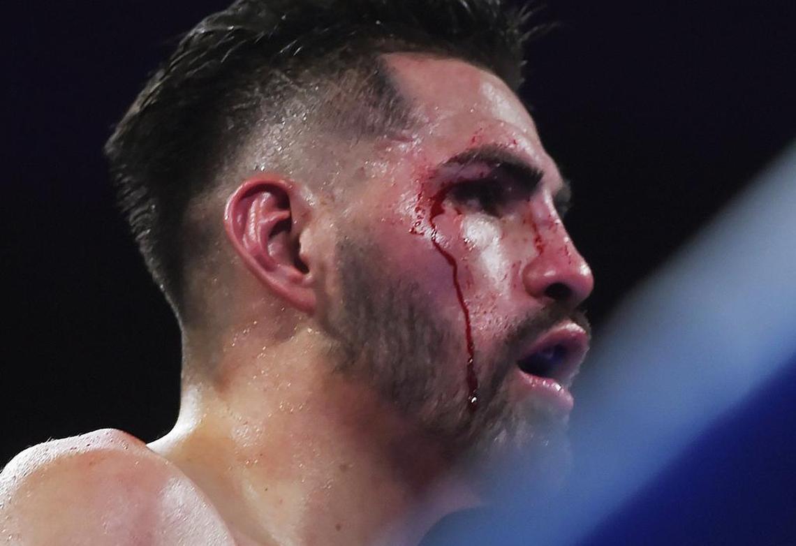 Jose Ramirez, bleeding, defends his WBC super lightweight title against Jose Zepeda at Save Mart Center Sunday, Feb. 10, 2019 in Fresno.