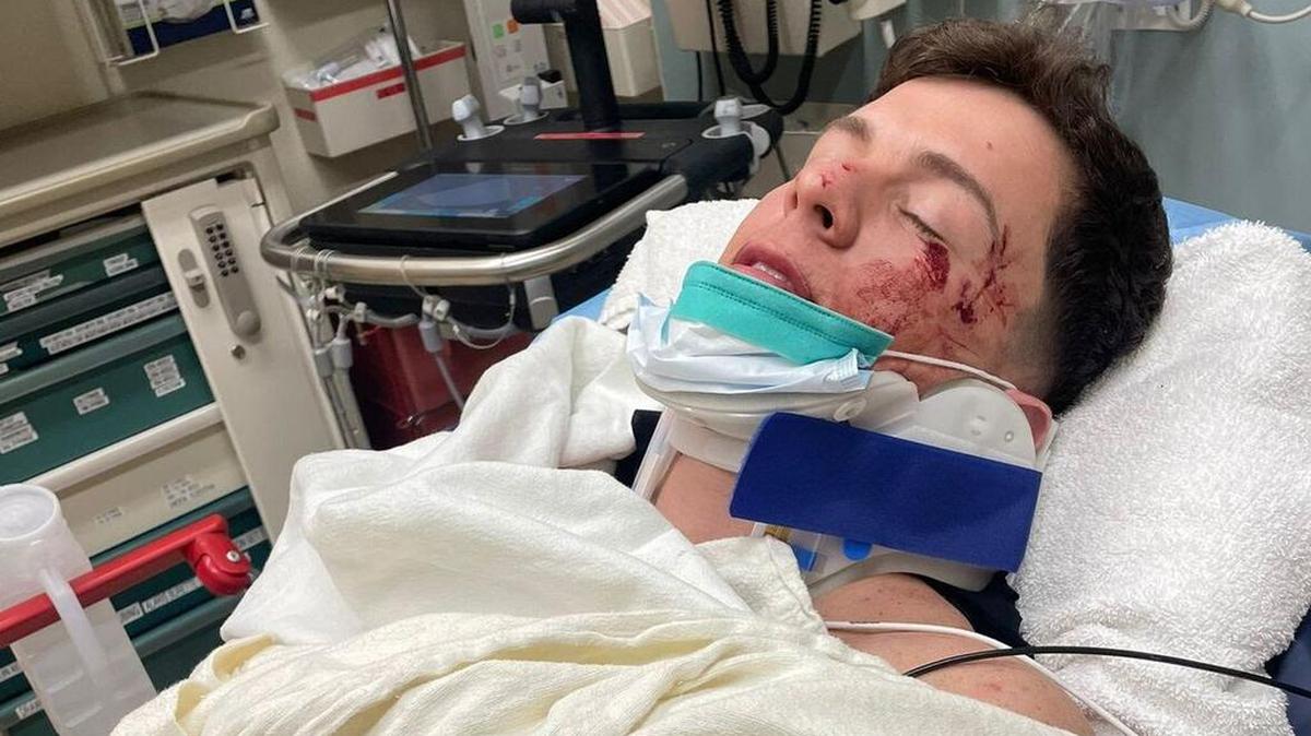 Fotografía cedida por French Toast Agency que muestra al cantante Guaynaa mientras esta ingresado tras un accidente de transporte en Los Ángeles.
